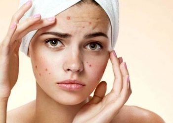 Kenali 7 Efek Samping Cream Wardah Pada Kulit Wajah