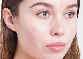 efek samping wardah white secret