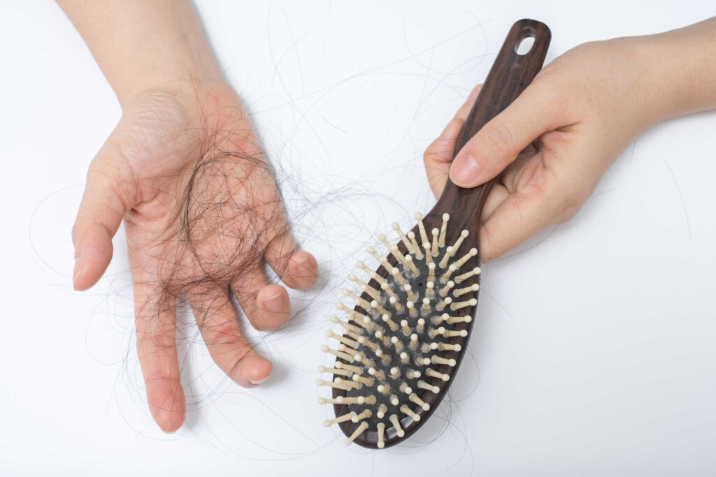 Merk Vitamin Untuk Rambut Rontok